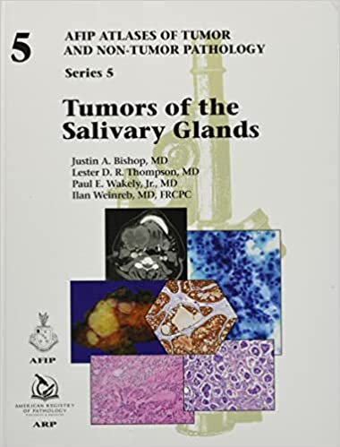 Tumors of the Salivary Glands: Series 5 (AFIP Atlas of Tumor and Non-Tumor Pathology, Series 5)