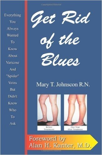 Get Rid of the Blues: Everything You Always Wanted to Know about Varicose and "Spider" Veins But Didn't Know Who to Ask
