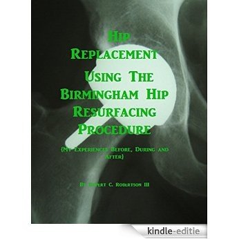 Hip Replacement Using The Birmingham Hip Resurfacing Procedure: My Experiences Before, During and After (English Edition) [Kindle-editie]