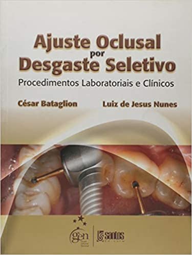 Ajuste Oclusal por Desgaste Seletivo. Procedimentos Laboratoriais e Clínicos